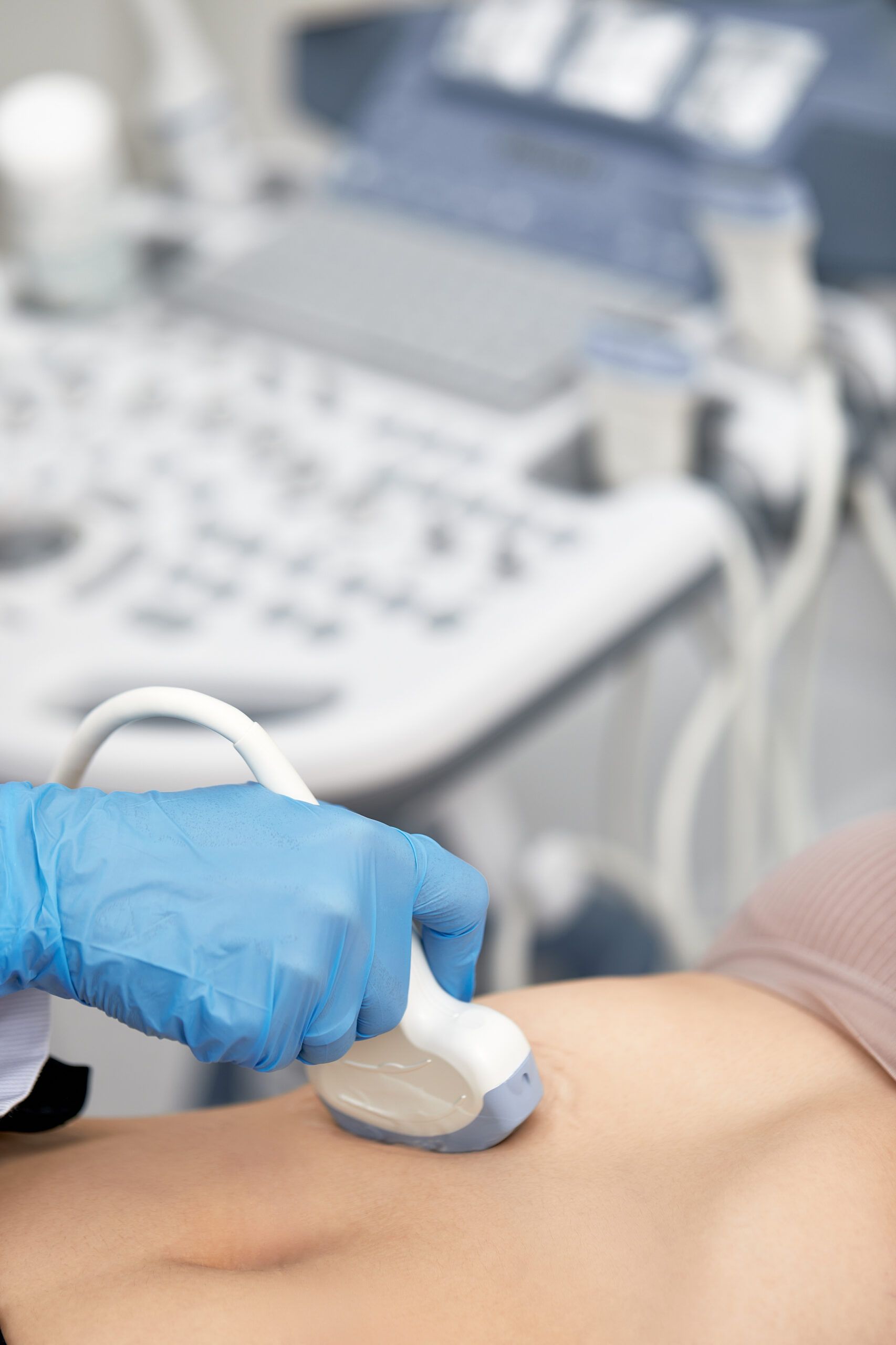 Female doctor gives the patient a female abdominal ultrasound. Ultrasound scanner in the hands of a doctor.